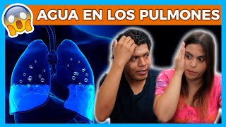 AGUA en los PULMONES es grave 😱 Sintomas de edema pulmonar 😵 Junica IRC [upl. by Anatole]