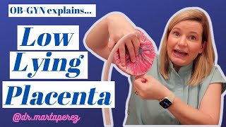 Low Lying Placenta Explained Risks Sex Exercise Csection vs Vaginal birth Marginal previa [upl. by Uhp]