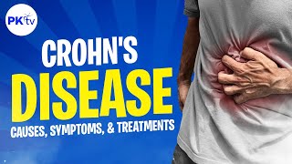 Crohns disease the causes symptoms and treatment  Poop Knowledge TV [upl. by Yoong]