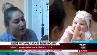 Kedi Miyavlaması Sendromu Hastalığı Olan Zeynep Bebek [upl. by Banyaz]