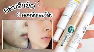 ปิดสิว รอยสิวเนียนกริบ ใช้คอนซีลเลอร์สิวตัวไหนดีสุด [upl. by Allesiram]