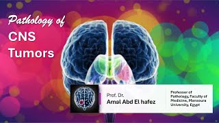 CNS Brain TumorsNeoplasms شرح محاضرة [upl. by Marci]