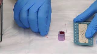 How to Measure the Hematocrit [upl. by Cathleen106]