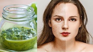 Get Rid of Freckles And Brown Spots By Using This Amazing Natural Remedy [upl. by Nyltyak374]