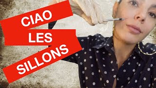 Comment Traiter les Sillons Nasogeniens Technique Détaillée sans Filler [upl. by Yeldoow]