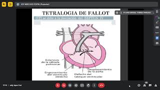 Cardiopatías congénitas cianóticas Dr m2024 01 25 [upl. by Blumenfeld470]