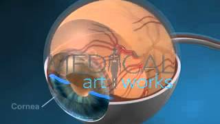 3D Medical Animation  Right eye anatomy showing retinal vessels optic nerve and normal anatomy [upl. by Atteynod]