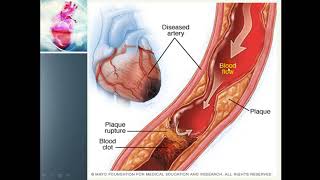 Ischemia  Myocardial Ischemia amp Its causes [upl. by Acirederf]