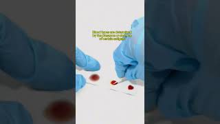 Blood typing [upl. by Raval]