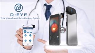 DEYE SmartphoneBased Retinal Camera Trailer [upl. by Pampuch]