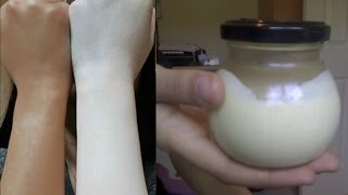 Skin Whitening Treatment 100 WorkingGet Fair Skin Naturally [upl. by Ardme618]