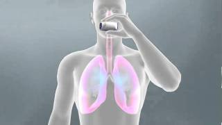 Respiratory Drug Delivery  Medical Animation by Watermark [upl. by Hniht195]