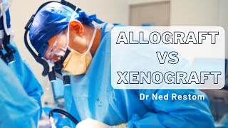 Interview with Dr Ned Restom  Allograft vs Xenograft [upl. by Yssis]