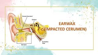 Impacted cerumen Definition of impacted cerumen  Causes of impacted cerumen Symptoms✨ [upl. by Jahdiel]