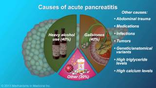 Acute Pancreatitis [upl. by Neehsas570]