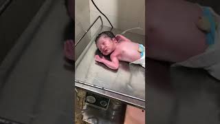 Cool New Born baby After Birth Oxygen Attached Done Already Suctioned [upl. by Ellehcor]