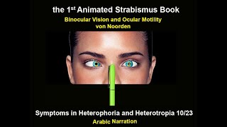 Symptoms in Heterophoria and Heterotropia and the Psychological Effects of Strabismus [upl. by Alyahs100]