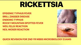 Rickettsia  Microbiology  Typhus fever  Weil felix test Rickettsial infection [upl. by Mcdowell]