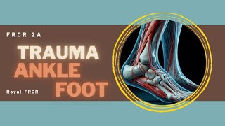 6  MSK amp Trauma Imaging for FRCR [upl. by Athene936]