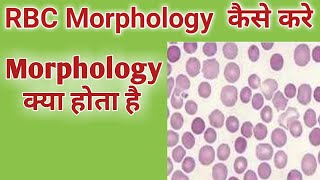 How to do rbc morphology  rbc morphology reporting  How to identify rbc morphology [upl. by Corin]