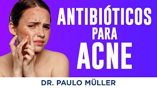 Antibióticos para Acne – Dr Paulo Müller Dermatologista [upl. by Alyks]