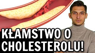 Cholesterol całkowity LDL HDL  normy to kłamstwo🤯Nowe i prawidłowe normy cholesterolu Szemraj [upl. by Sonya813]