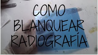 como limpiar o blanquear radiografía para stencil o grabado [upl. by Arrek]