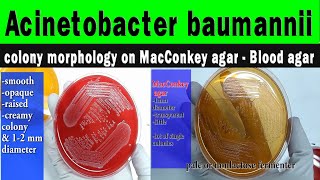 Acinetobacter colony morphology on MacConkey agarBlood agar diagnostic featurespreventive methods [upl. by Arata]