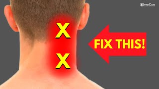 How to Fix Neck Pain off to the Side [upl. by Ahsiener98]