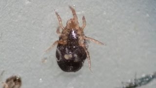 Biting Bird Mites Under the Microscope  Ornithonyssus sp [upl. by Ylellan]