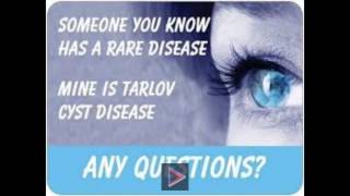 Tarlov Cyst Disease  Much More than an Incidental Finding  AJNR [upl. by Filmer]