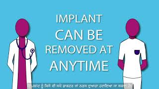 NHS Contraceptive Implant Information Video  Punjabi Subtitles [upl. by Valera715]