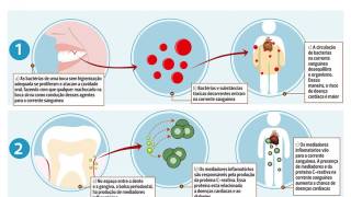 Medicina Periodontal [upl. by Quar]