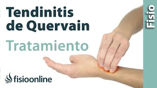 Tendinitis de De Quervain  Tratamiento con ejercicios automasajes y estiramientos [upl. by Candace248]