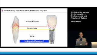 Peri Implant Mucositis vs PeriImplantitis  HOW TO MAINTAIN YOUR DENTAL IMPLANTS [upl. by Micco]