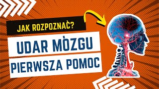 Udar mózgu pierwsza pomoc🚨 udar [upl. by Ellehsal]