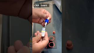 CRP test  CReactive Protein CRP test कैसे करते हैं 😯 POSTIVENEGATIVE tranding shortvideo [upl. by Nyliak]