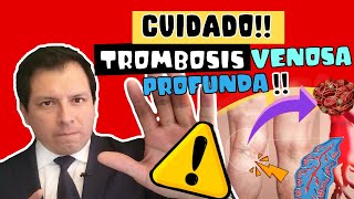 CUIDADO ⚠️ TROMBOSIS VENOSA PROFUNDA  SÍNTOMAS Y COMPLICACIONES 😱😱😱 [upl. by Axel528]