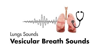 Breath Sounds in Different Clinical Conditions on Examination [upl. by Ainoda]