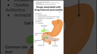 Drugs associated with druginduced pancreatitis [upl. by Miuqaoj]