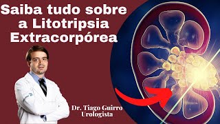 Saiba tudo sobre a Litotripsia Extracorpórea [upl. by Itsrik]