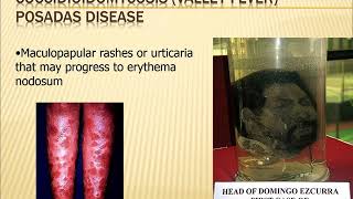 systemic mycoses [upl. by Gusba]