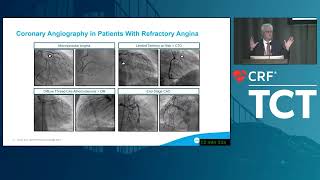 TCT 2023 COSIRA II Symposium Shockwave Medical [upl. by Fidellas]