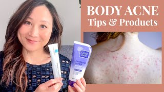 How to treat BODY ACNE  Back Chest amp More  Dr Jenny Liu [upl. by Tiloine]