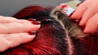 Silent ASMR Scalp Treatment Gentle Exfoliation amp Dandruff Removal No Speaking [upl. by Egoreg480]