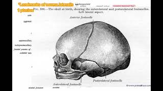 Pterion norma lateralis anatomy skull headandneckanatomy [upl. by Tymes]