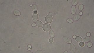 Bakers Yeast under the Microscope [upl. by Uaerraj]