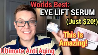 INSTANT 20 MIRACLE EYE LIFT  Remove Crows Feet Without Botox [upl. by Remlap]