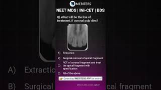 NEET MDS  INICET MDS  PSC  BDS  Most Important Questions neetmds2025 mdsprep [upl. by Ailimat]