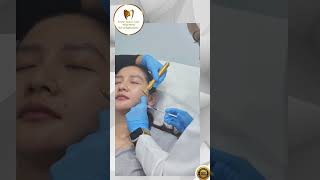 Jaw Botox Procedure [upl. by Athalee]